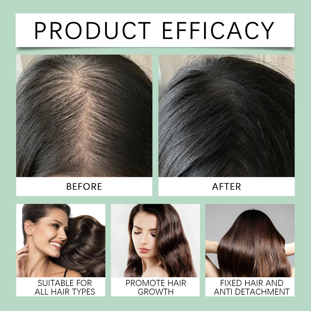 HOEGOA Batana Oil Shampoo – Moisturizing Scalp Cleanser Moisturizing Shampoo QXL