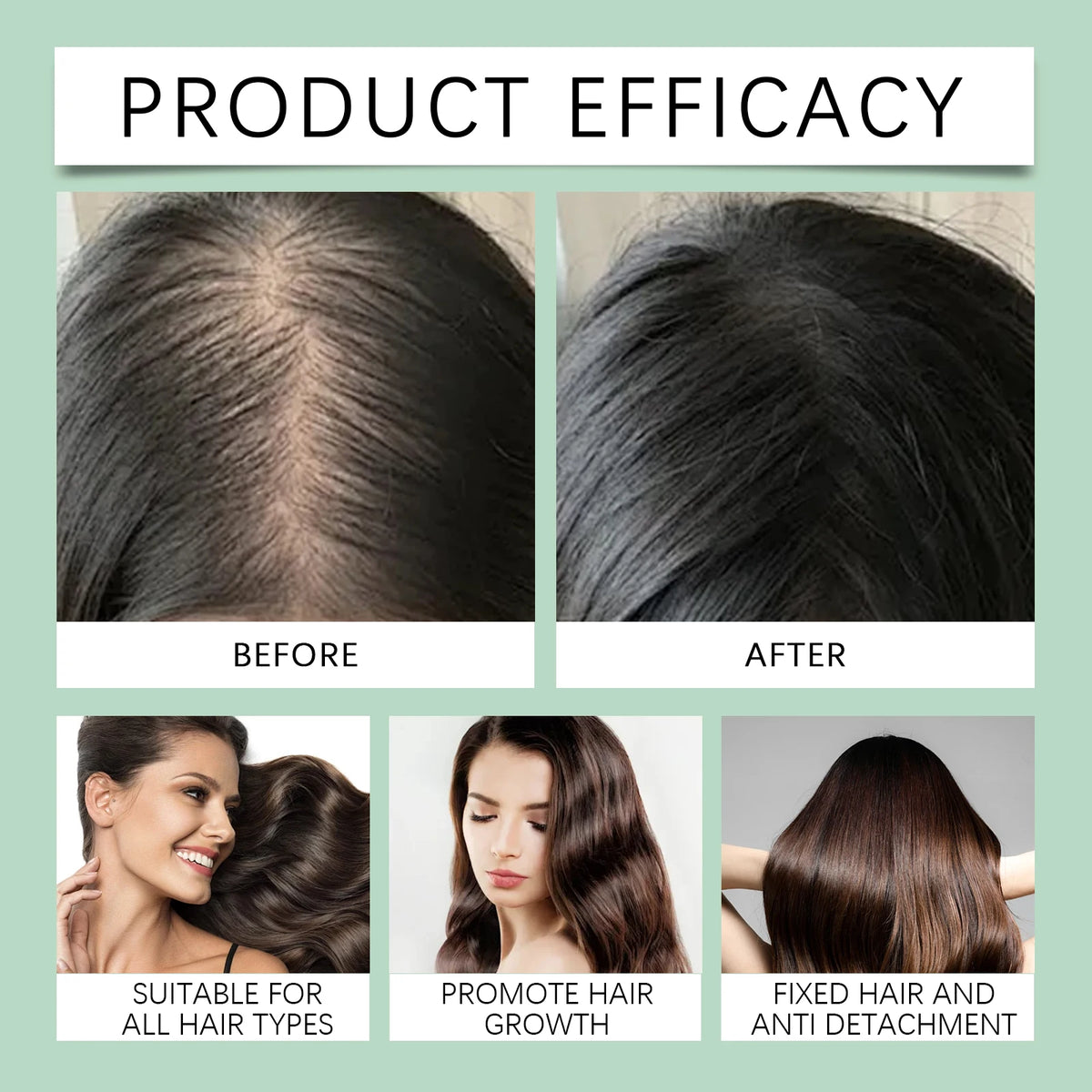 HOEGOA Batana Oil Shampoo – Moisturizing Scalp Cleanser Moisturizing Shampoo QXL