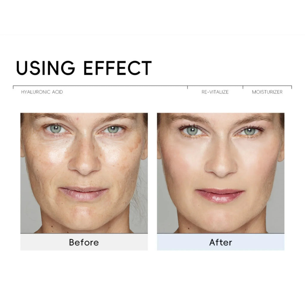 QUIYUM Hyaluronic Acid Face Cream – Hydrate & Brighten Hyaluronic Acid Moisturizer QXL