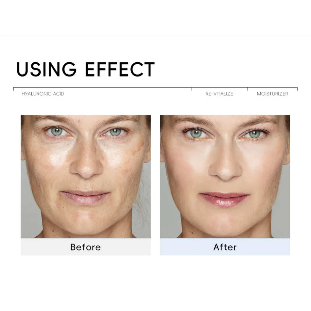 QUIYUM Hyaluronic Acid Face Cream – Hydrate & Brighten Hyaluronic Acid Moisturizer QXL