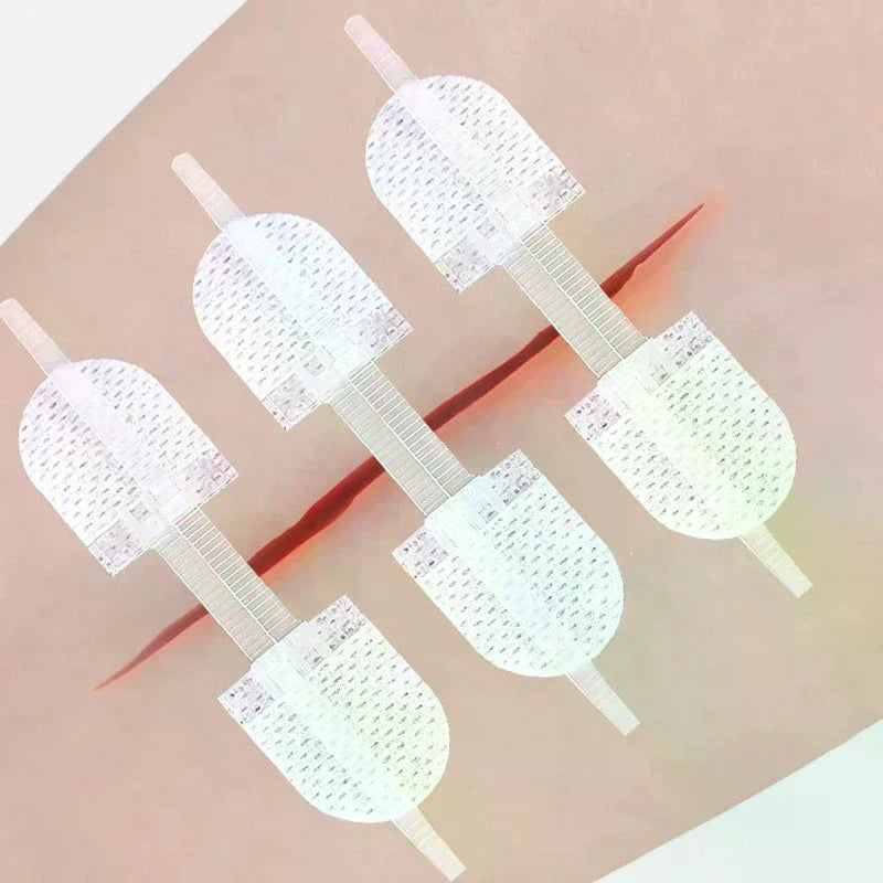 Zipper Wound Closure Patches | Breathable Elastic Bandage Wound Closure Patch QXL