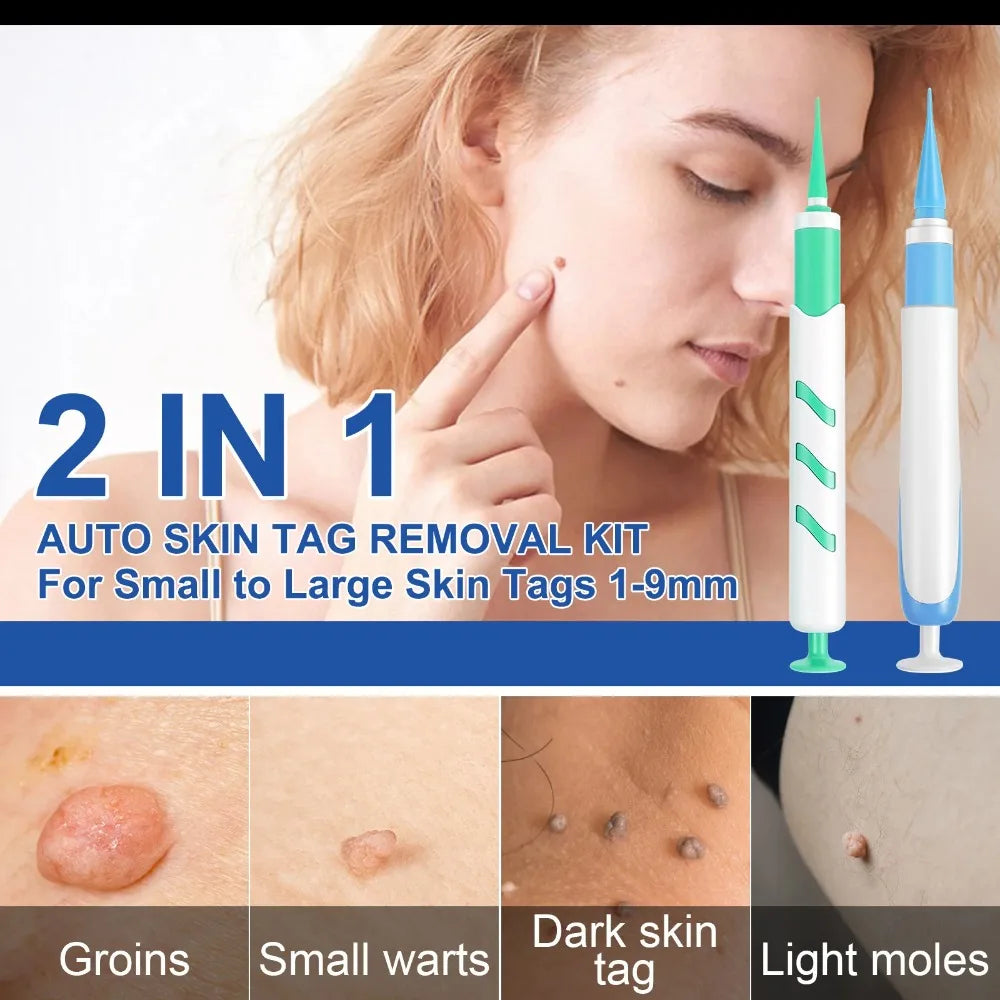 2-in-1 Auto Skin Tag Removal Kit | 60 Bands, 1–9mm Skin Tag Removal Kit QXL