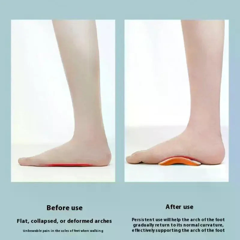 EVA Arch Support Insoles – Flat Feet Shoe Inserts Men & Women Arch Support Insoles QXL