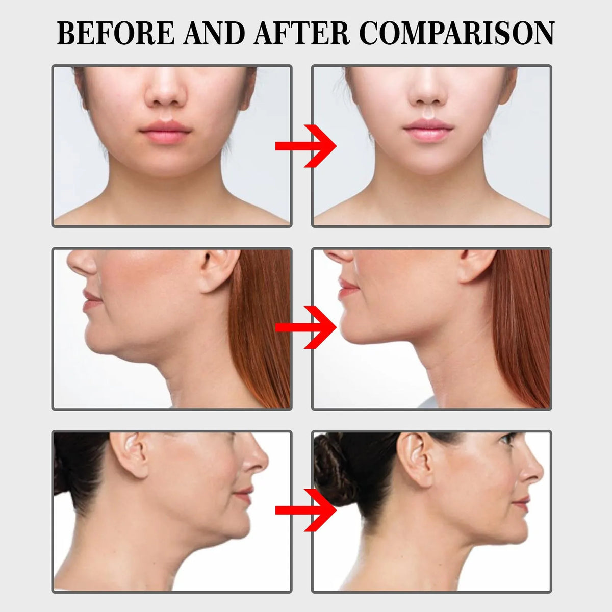 V-Lift Invisible Face Lift Patches | Chin & Jawline Contouring Face Lift Patch QXL