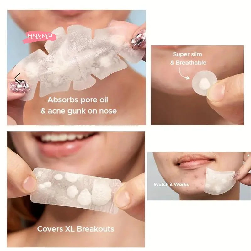 128-Pack Hydrocolloid Acne Patches | Invisible Salicylic Dots Acne Patch Set QXL