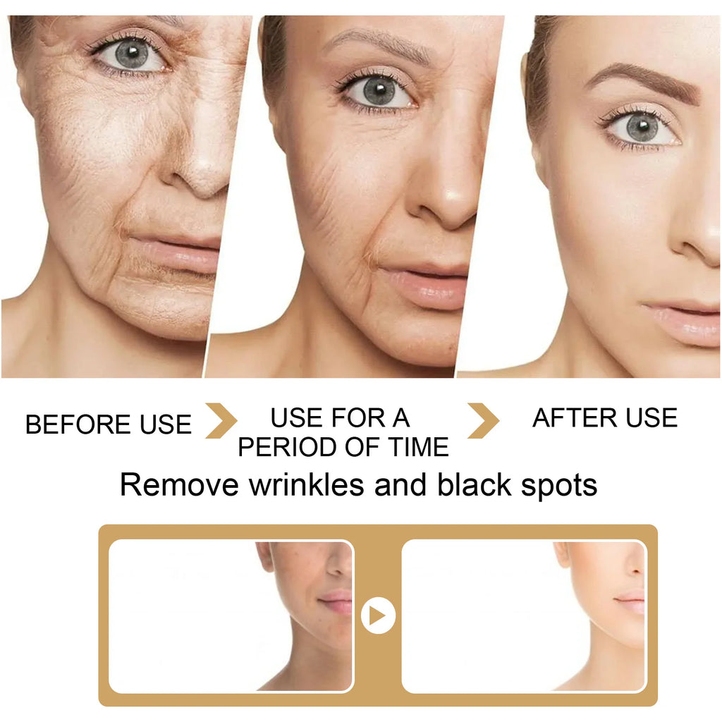 Eelhoe Turmeric Face Serum – Brightening & Dark Spot Essence Brightening Face Serum QXL
