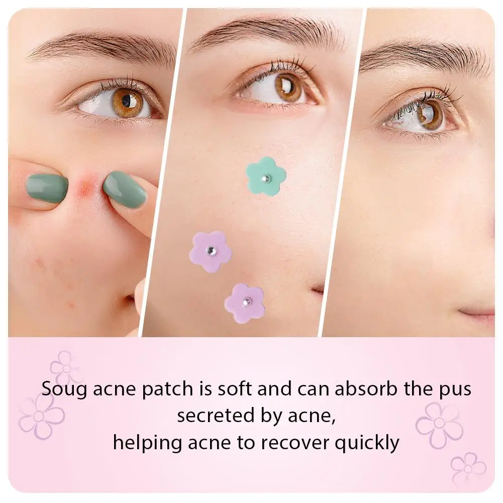 Flower-Shaped Hydrogel Blemish Patches | Pearl & Diamond Design Hydrogel Blemish Patch QXL