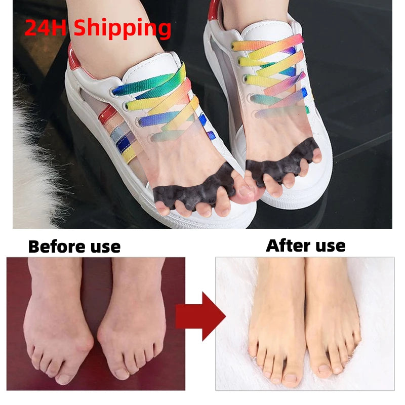 Silicone Gel Toe Separator & Straightener – 1 Pair Toe Separator QXL