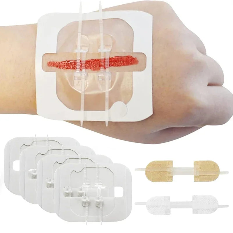 Butterfly Closure Bandage Strips | Adhesive Wound Closure Patches Wound Closure Strips QXL