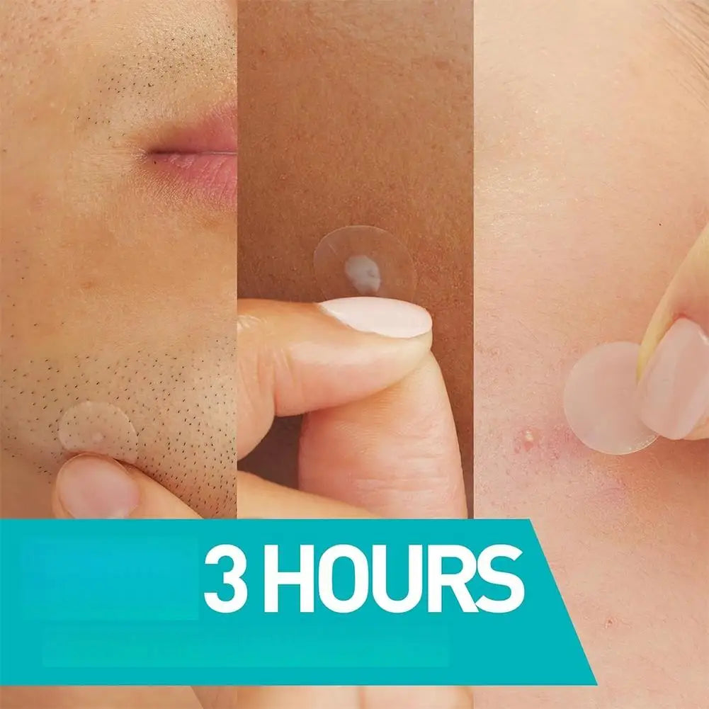 Invisible Acne Spot Patches 24/200/800 Pcs | Hydrocolloid Acne Spot Patch QXL