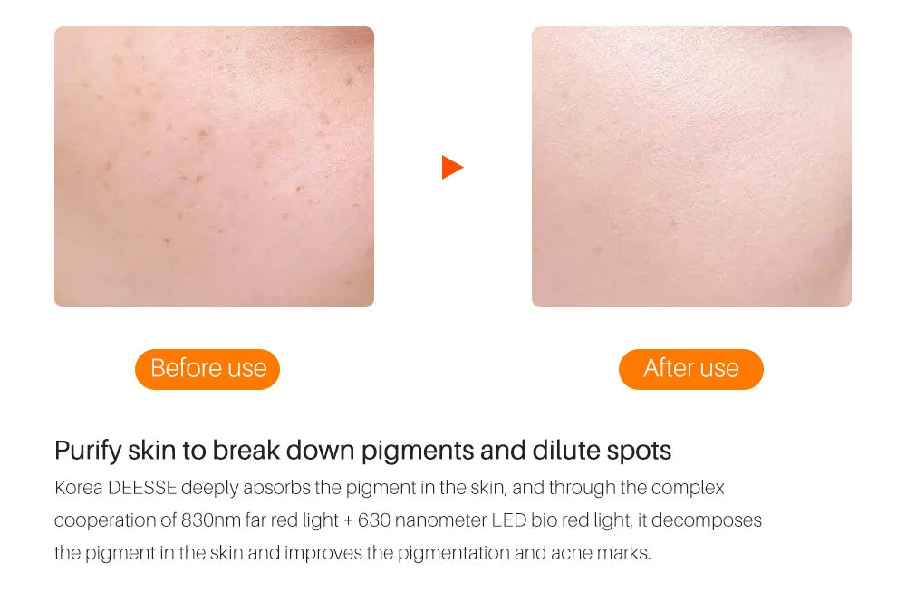 7-Color LED Photon Therapy Face Mask | Skin Rejuvenation LED Therapy Face Mask QXL