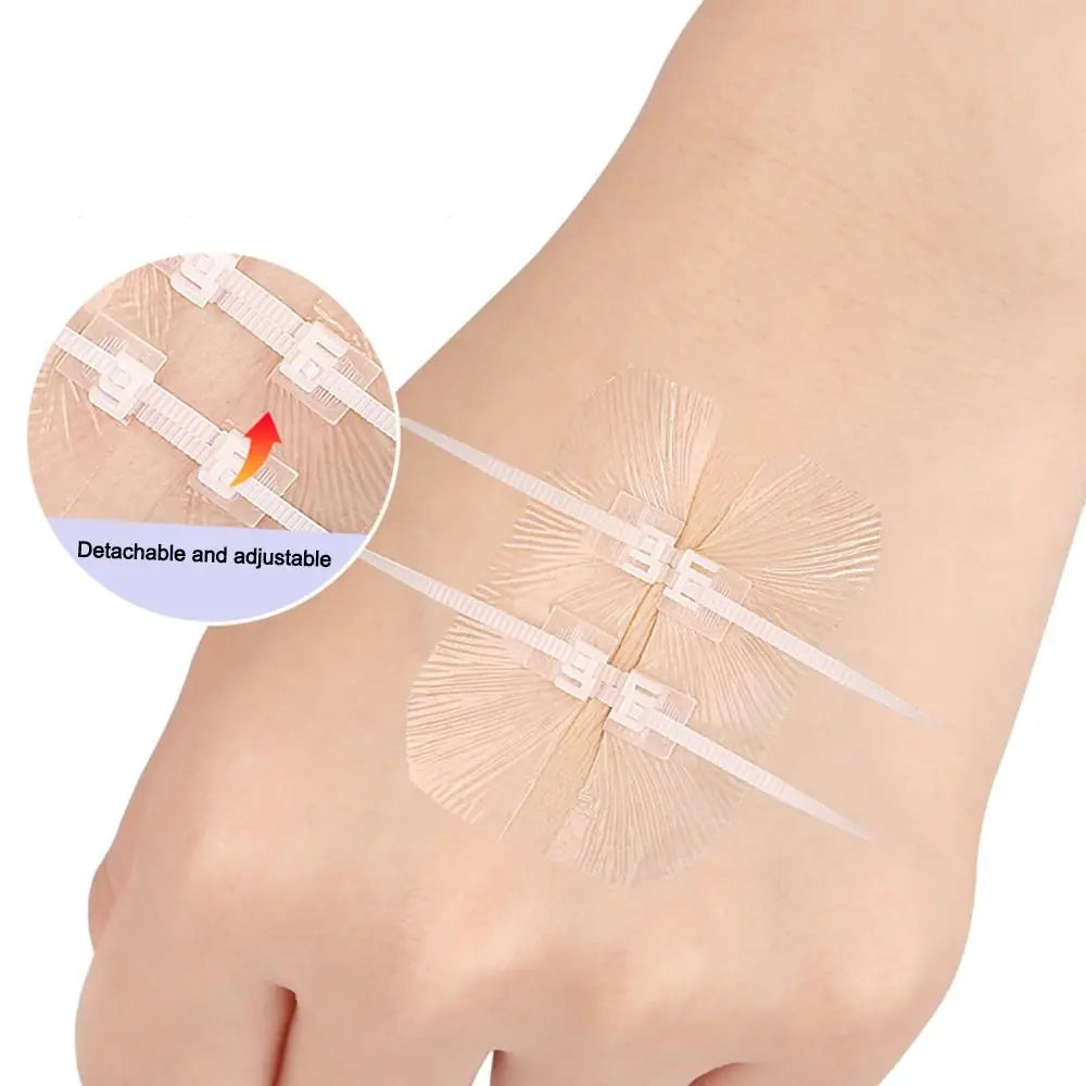 Zip Suture Wound Closure Strips | No-Stitch First Aid Bandage Wound Closure Strips QXL