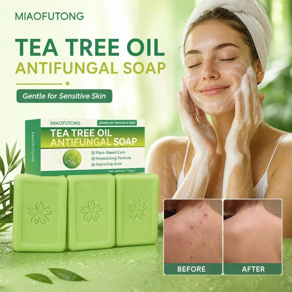 3-Pack Tea Tree Oil Bar Soap | Deep Cleanse Oily Sensitive Skin Cleansing Bar Soap QXL