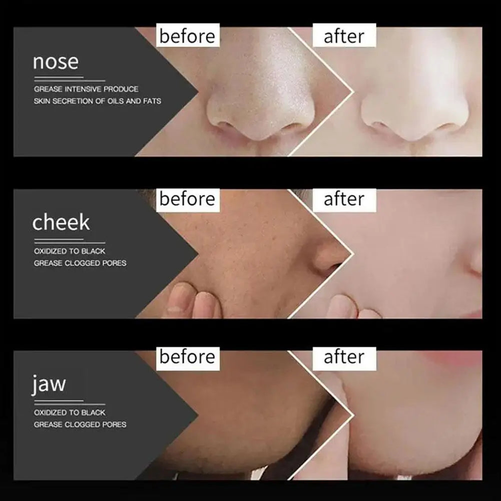 Bamboo Charcoal Blackhead Peel-Off Face Mask 60g Peel-Off Face Mask QXL