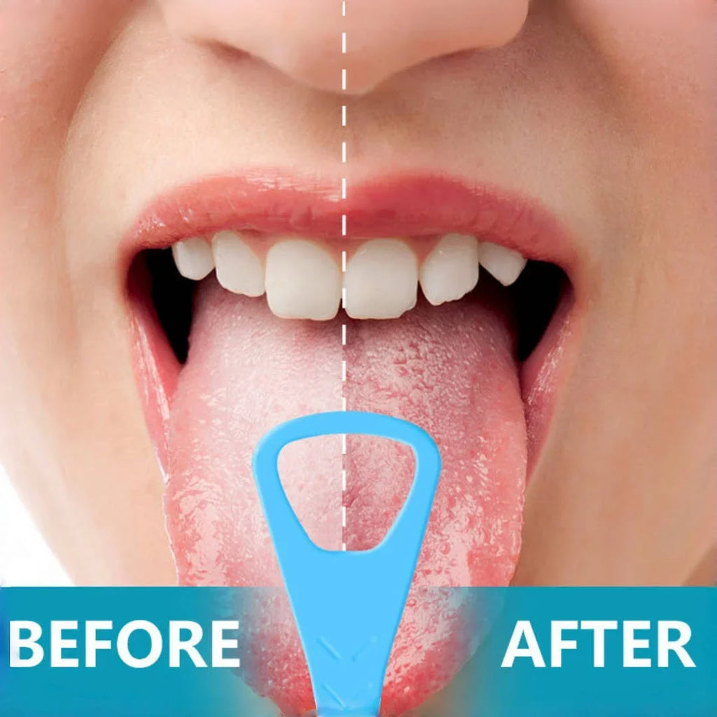 20-Pack Foldable Tongue Scraper & Dental Pick | 2-in-1 Oral Care Tongue Scraper Set QXL