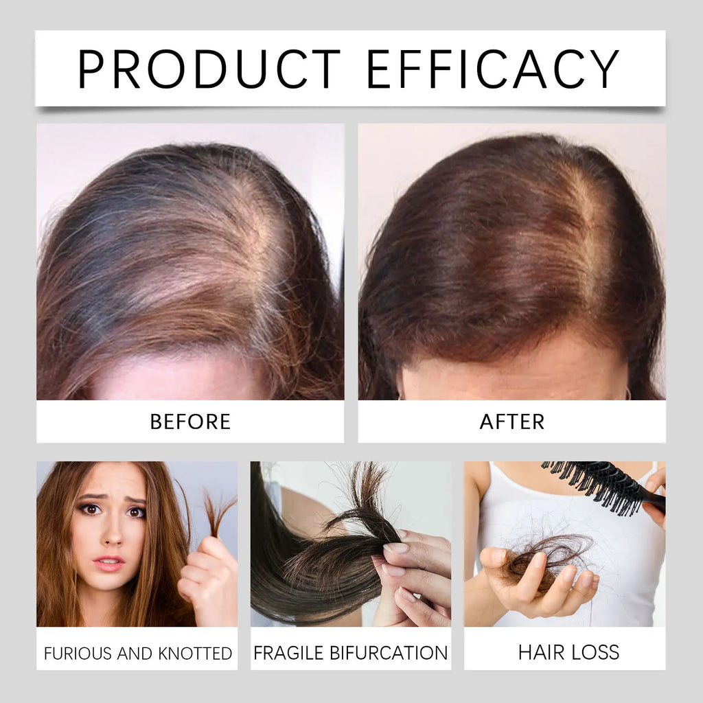 Eelhoe Rosemary & Ginger Deep Conditioning Hair Mask 120g Hair Conditioning Mask QXL