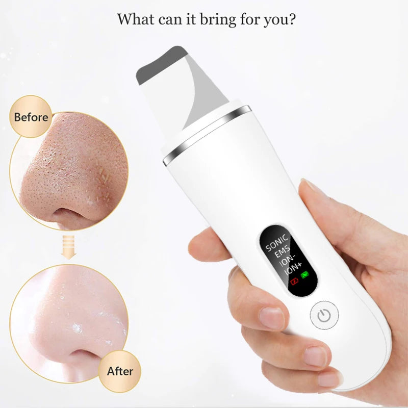 Ultrasonic Skin Scrubber | 4-Mode Facial Cleansing Spatula Facial Cleansing Spatula QXL