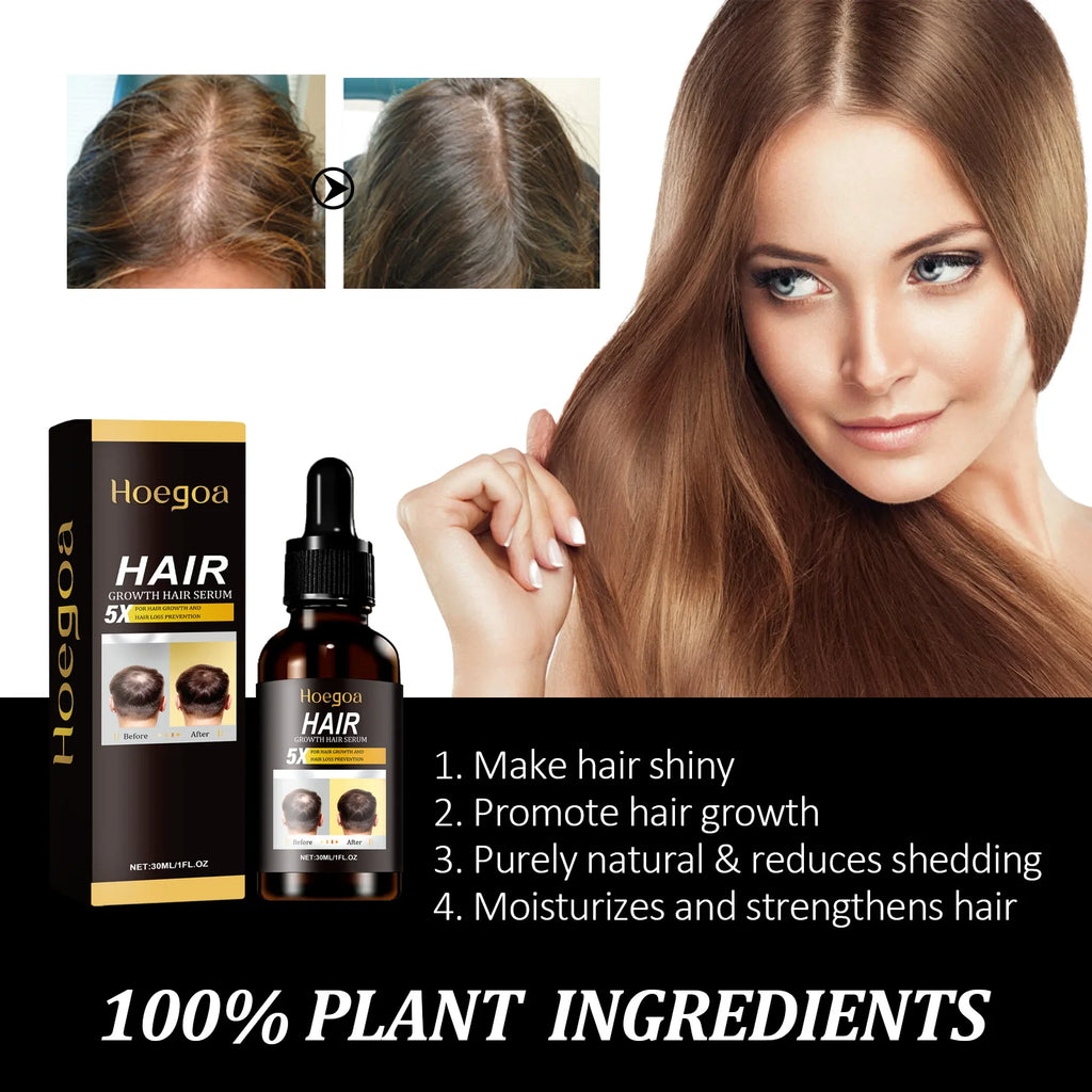 HOEGOA Ginger Hair Growth Serum Oil – Nourishing Scalp Essence Hair Growth Serum QXL