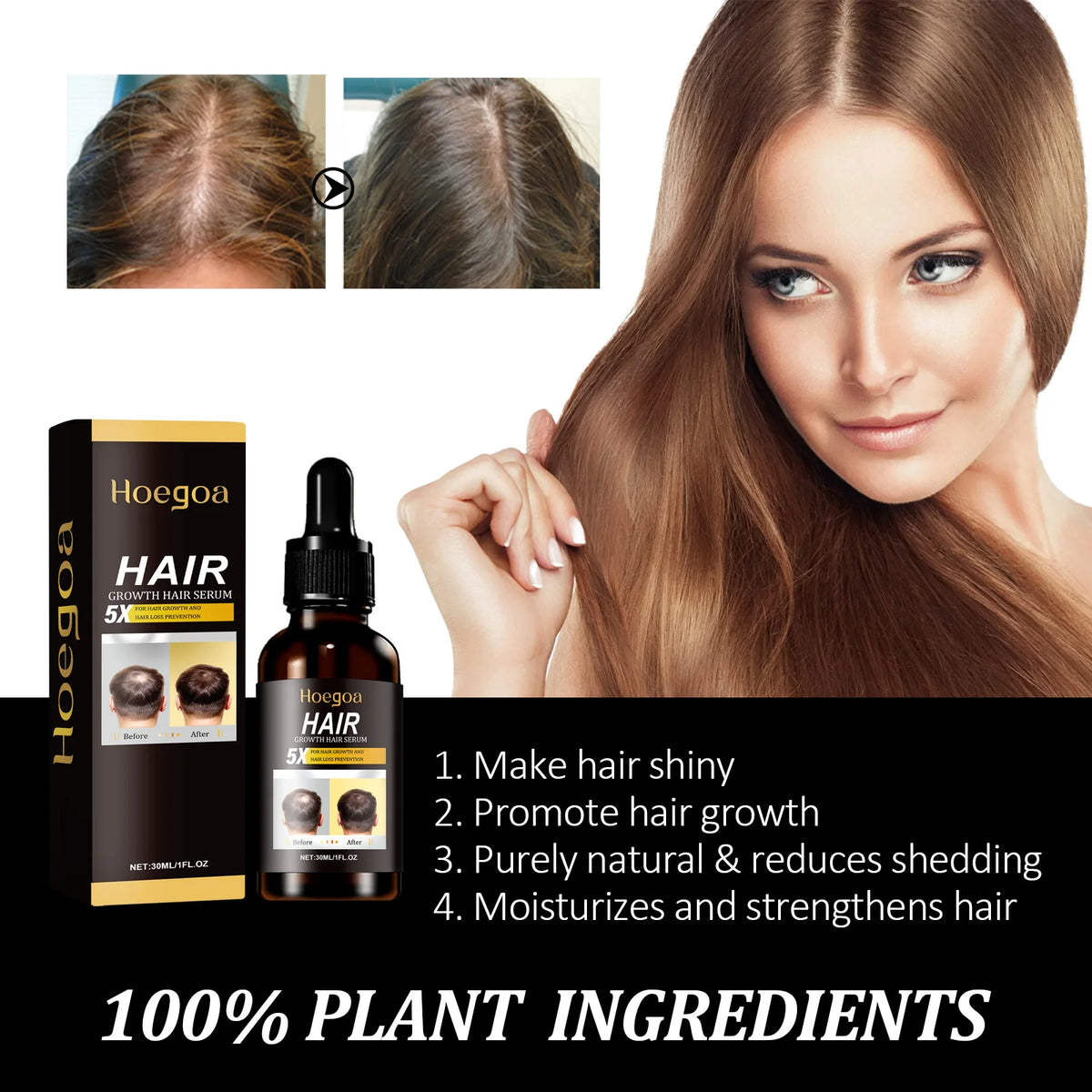 HOEGOA Ginger Hair Growth Serum Oil – Nourishing Scalp Essence Hair Growth Serum QXL