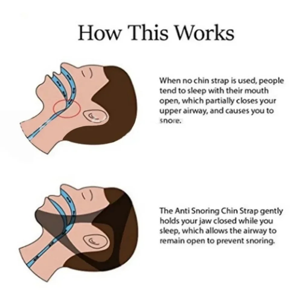 Adjustable Anti-Snoring Chin Strap | Jaw Support Sleep Band Anti-Snoring Chin Strap QXL