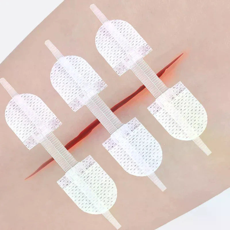 Zipper Wound Closure Patch | Elastic Breathable Bandage Strip Wound Closure Patch QXL