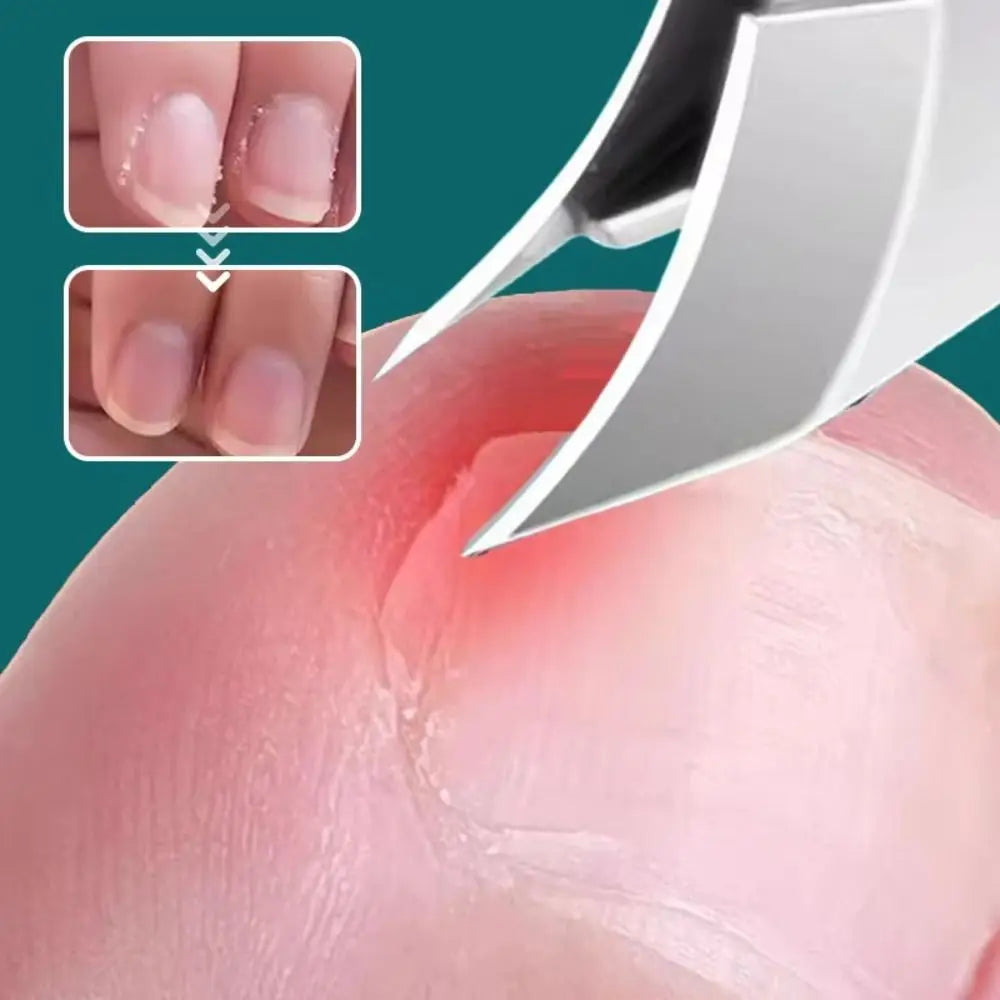 Anti-Splash Slant Edge Toenail Clipper | Stainless Steel Toenail Clipper QXL