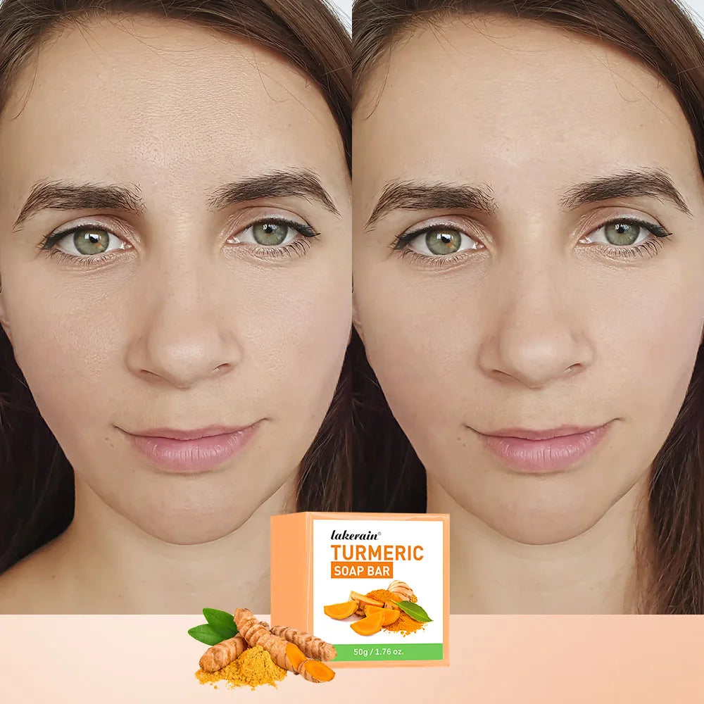 Turmeric Kojic Acid Soap Bar | Natural Exfoliating Skin Cleanser Natural Soap Bar QXL