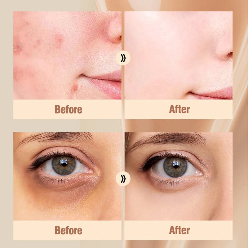 Liquid Concealer Cream – Full Coverage, All Skin Types Liquid Concealer Cream QXL