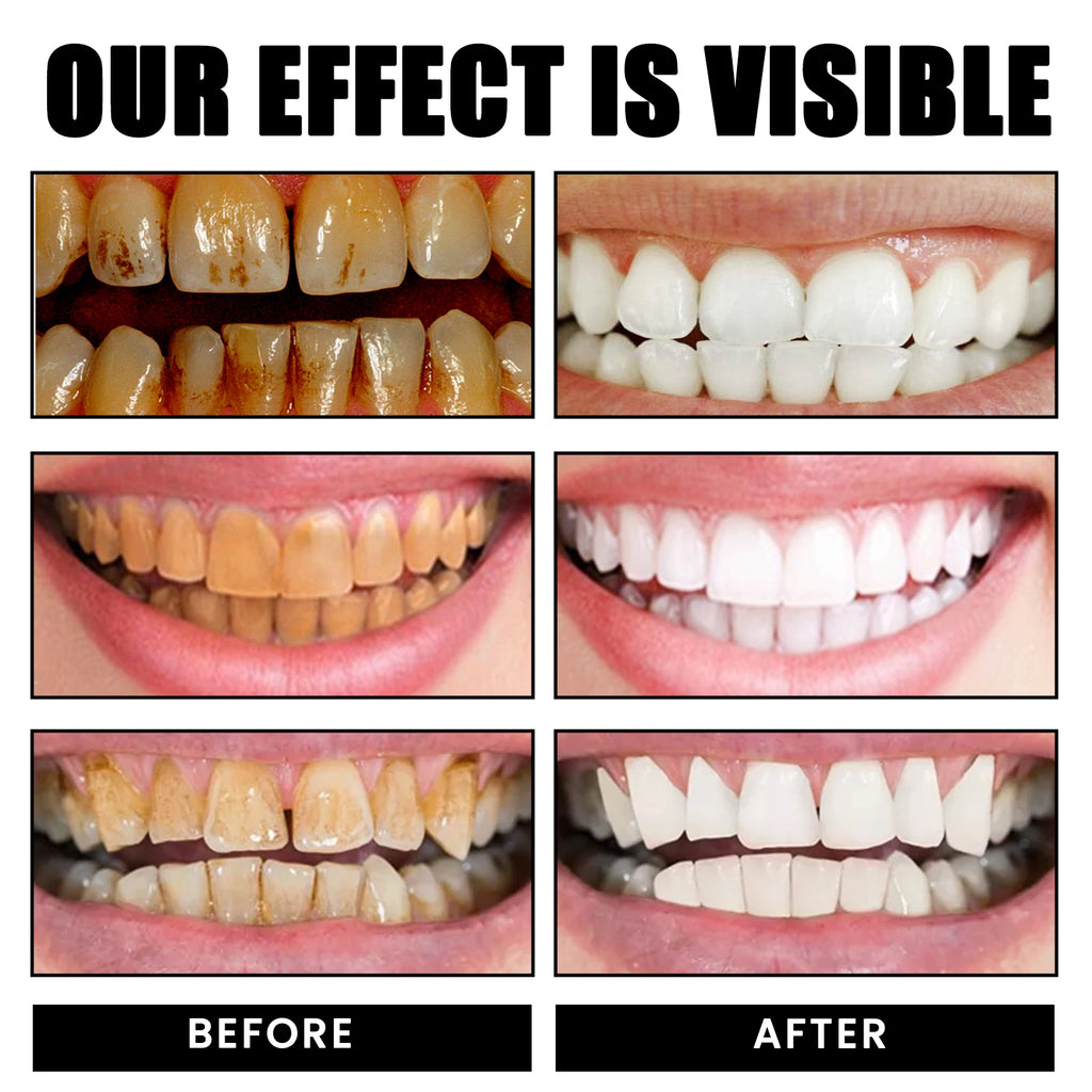 Eelhoe Xylitol Probiotic Whitening Toothpaste 120g Whitening Toothpaste QXL